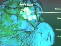 Immagine TAC del cranio di SUE, con evidenziato il grande bulbo olfattivo.